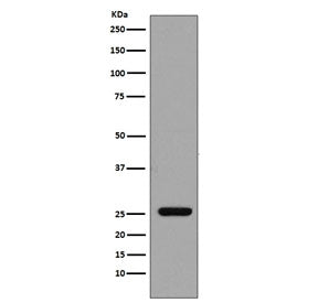 GST pi Antibody / GSTP1