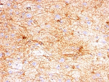 GFAP Antibody / Glial Fibrillary Acidic Protein