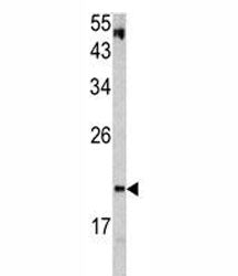 VHL Antibody
