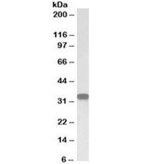 CD20 Antibody