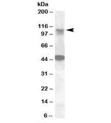 Western blot testing of human ovay lysate with LIP1 antibody at 0.5ug/ml. The expected ~110kDa band 
