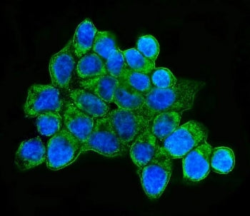 Immunofluorescent staining of FFPE human MCF7 cells with HLA-DQB1 antibody (green) and DAPI nuclear 