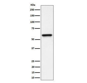 Western blot testing of human HeLa cell lysate with Regulator of G-protein signaling 6 antibody. Pre