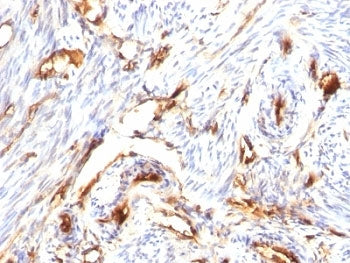 Beta-2 Microglobulin Antibody