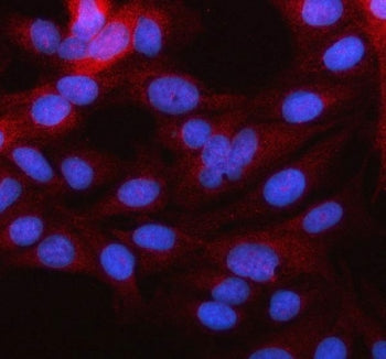 MARCHF2 Antibody / MARCH2 / Membrane-associated RING finger protein 2
