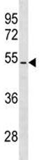 PTEN Antibody