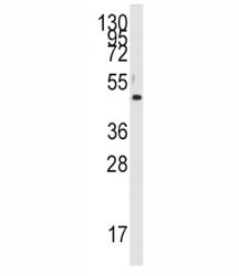 PDK4 Antibody