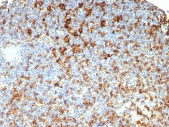 HLA-DRB Antibody