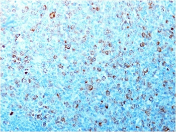 CDK1 Antibody