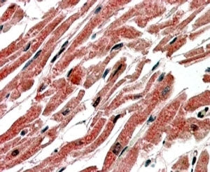 IHC testing of FFPE human heart with CPT1B antibody at 4ug/ml. HIER: steamed with pH6 citrate buffer