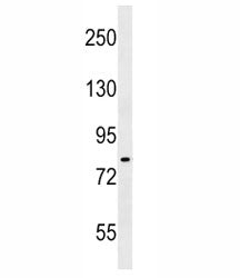 IKK Antibody (alpha/beta)
