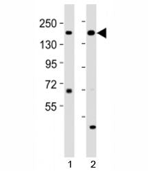 Western blot testing of Kdm6a antibody at 1:2000 dilution. Lane 1: mouse cerebellum lysate; 2: mouse