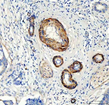 Collagen IV Antibody / COL4A2 (Canstatin fragment)