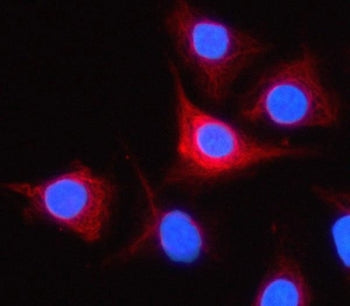 Immunofluorescent staining of FFPE human A549 cells with TESSP-4 antibody (red) and DAPI nuclear sta