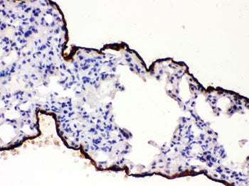 IHC testing of FFPE mouse lung with Mesothelin antibody. HIER: Boil the paraffin sections in pH 6, 1