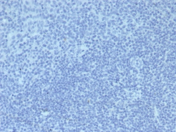 IHC staining of FFPE human tonsil tissue with Mouse IgG2a Isotype Control antibody (clone IGG2a/6723