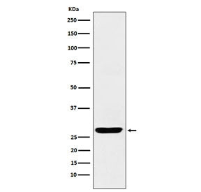 Western blot testing of human fetal brain lysate with SCGN antibody. Predicted molecular weight ~32 