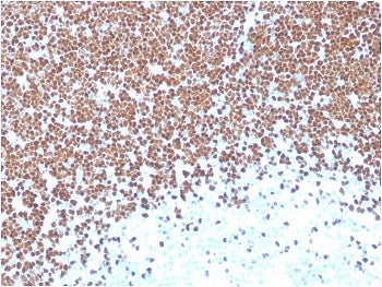IHC staining of FFPE human thymus with TdT antibody (clone TDT/1393). HIER: boil tissue sections in 