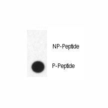Dot blot analysis of phospho-FABP4 antibody. 50ng of phos-peptide or nonphos-peptide per dot were sp