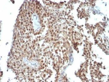 p21 Antibody / CDKN1A