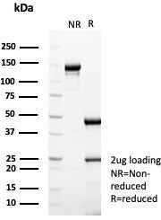 Estrogen Receptor alpha Antibody