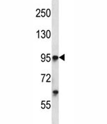 Tie1 Antibody