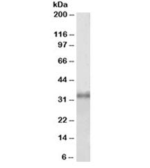 Fibrillarin Antibody
