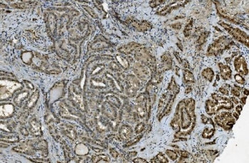 TKT Antibody / Transketolase