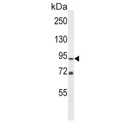 Phospholipase D2 Antibody / PLD2