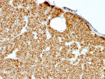 Parathyroid Hormone Antibody / N Terminal