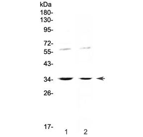 Western blot testing of human 1) HeLa and 2) SW620 cell lysate with IL12 p35 antibody at 0.5ug/ml. P