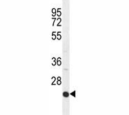 ICAM2 Antibody