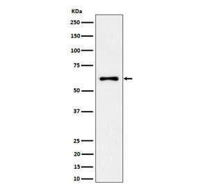 EYA2 Antibody / Eyes absent homolog 2