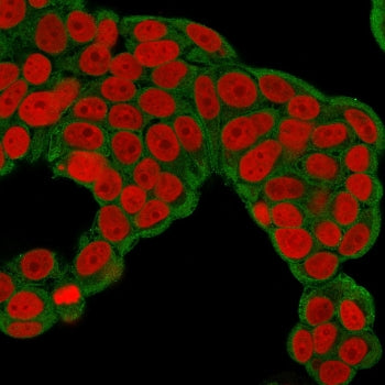 CHP2 Antibody / Calcineurin B homologous protein 2