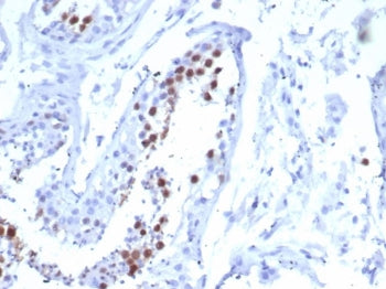 IHC staining of FFPE human testis tissue with Kinesin Family Member 2C antibody (clone KIF2C/6518) a