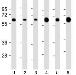PGM1 Antibody / Phosphoglucomutase 1