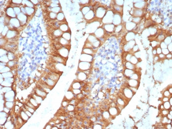 IHC staining of FFPE human small intestine tissue with I-FABP antibody (clone FABP2/7670). HIER: boi