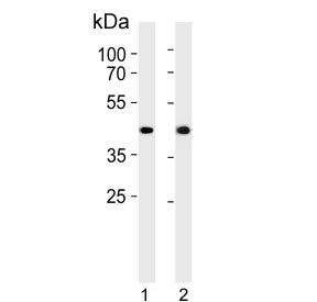 ADH7 Antibody