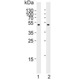 Carboxypeptidase M Antibody / CPM