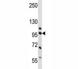 Western blot analysis of NCL and human placenta tissue lysate. Predicted molecular weight is 77 kDa,