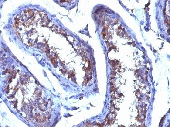 Testosterone Antibody