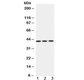 Western blot testing of 1) rat liver, 2) mouse NIH3T3 and 3) human HepG2 lysate with EBP1 antibody a