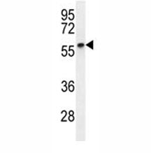 Cyclin B1 Antibody (CCNB1)