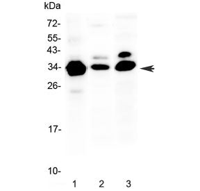 IL1 beta Antibody