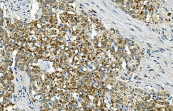 IDH2 Antibody / Isocitrate dehydrogenase 2