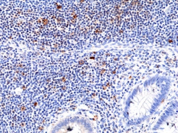 ICOS Antibody / Inducible T-cell costimulator / CD278