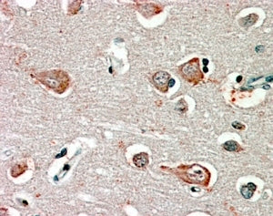 GABRB3 Antibody