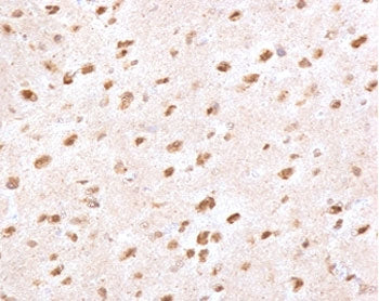 Ubiquitin Antibody