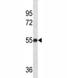 LOX Antibody