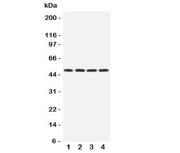 Western blot testing of HYAL1 antibody and Lane 1: rat NRK; 2: mouse liver; 3: (m) kidney; 4: (m) SP